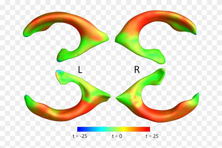 Gutman Ba, Wang Y, Yanovsky I, Hua X, Toga Aw, Jack Clipart