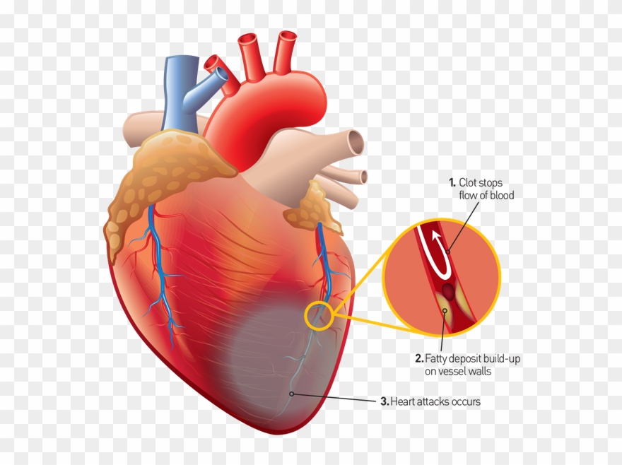 Some Organic Acids Present In Coriander, Such As Oleic Clipart