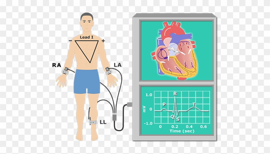 Ecg Cartoon Clipart Electrocardiography The Electrocardiogram - Png Download