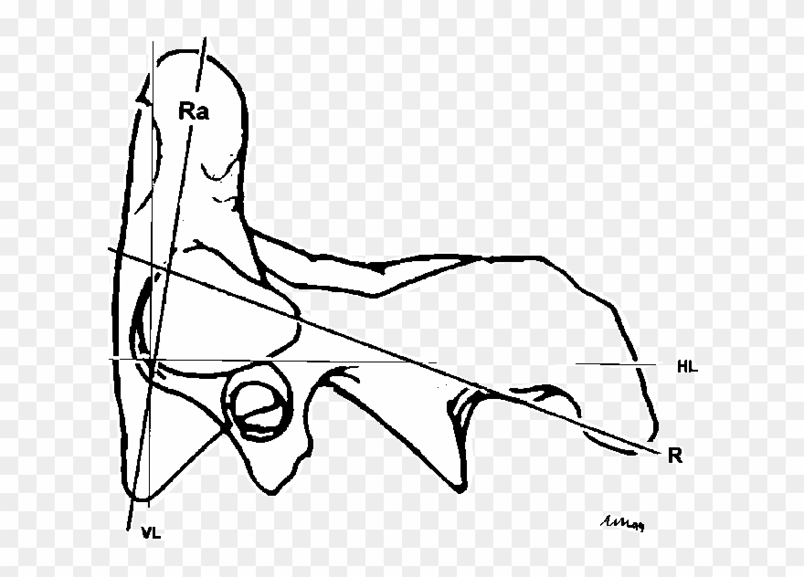 Description Of Measurements Taken From The Lateral Clipart
