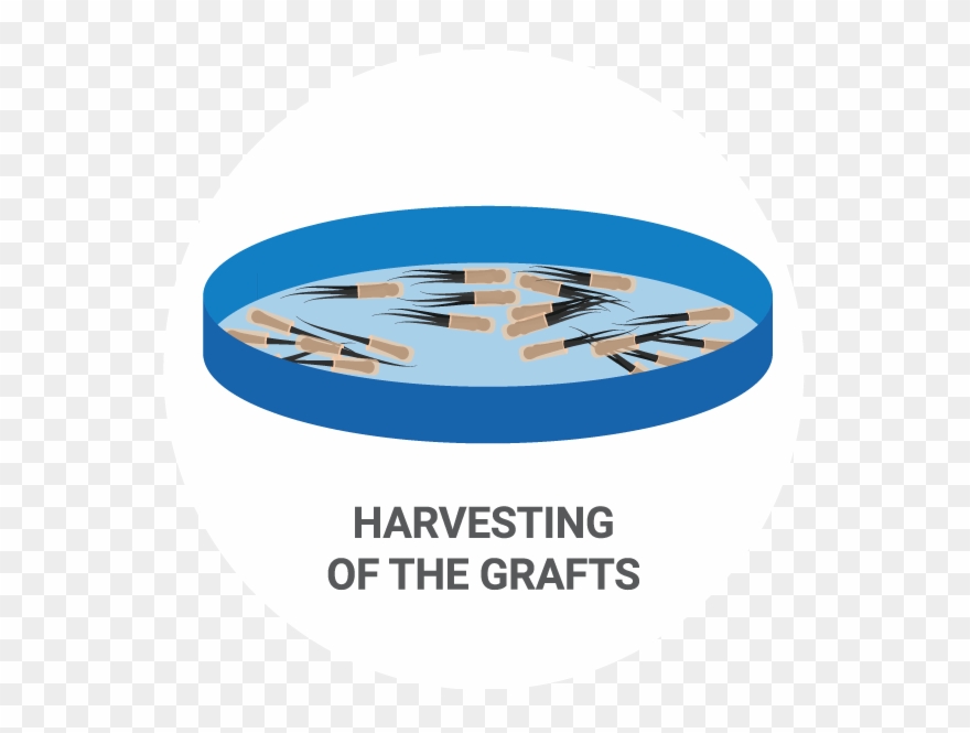 Beard Transplant Procedure Clipart