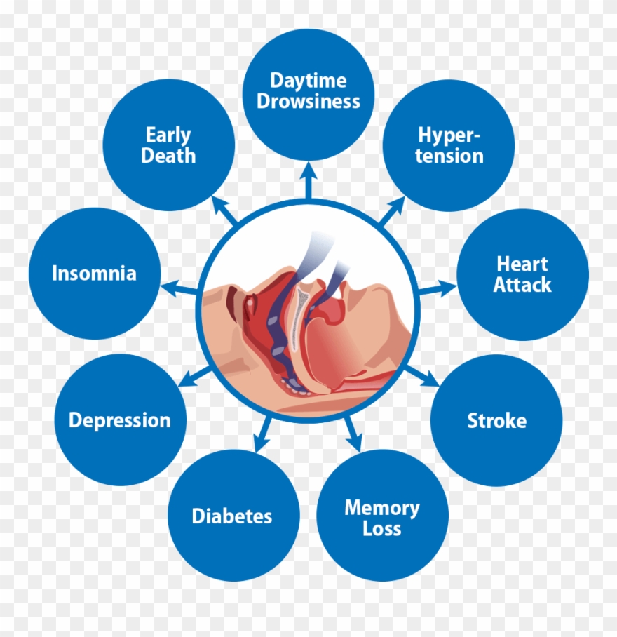 Consequences Clipart