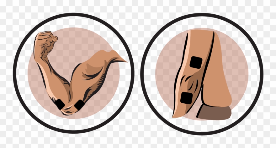 Elbow Electrode Pad Placement Clipart