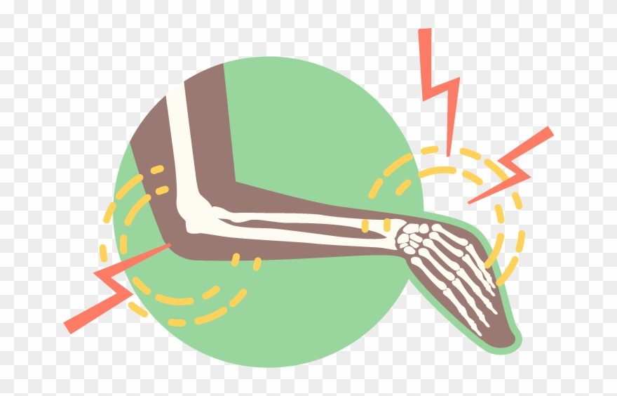 Hand, Wrist & Elbow Conditions Clipart