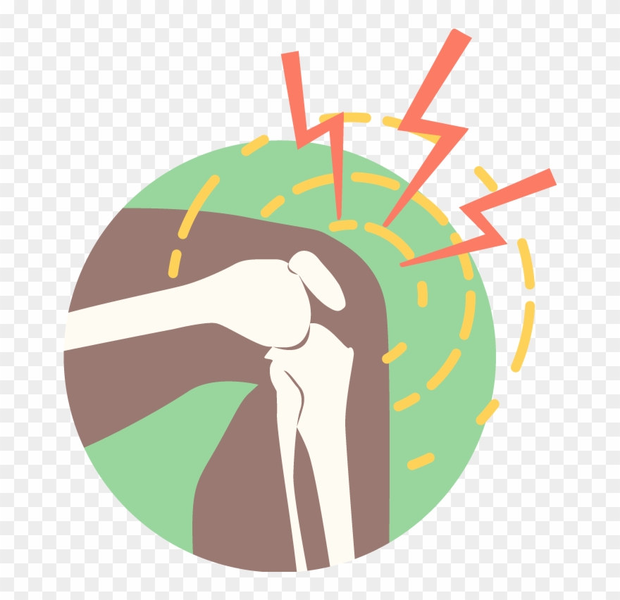 Knee-conditions Clipart