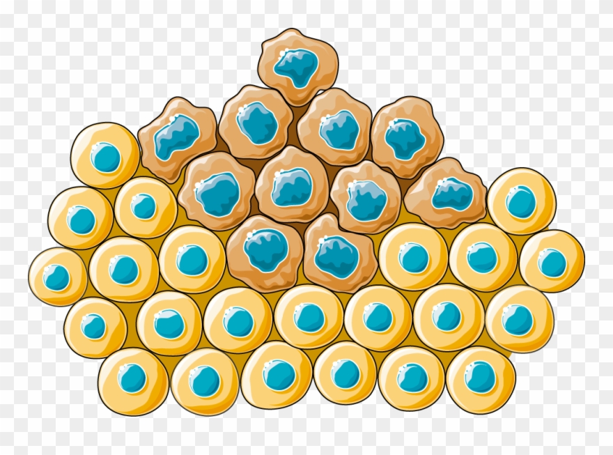 Carcinoma - Cancer Cell Clipart - Png Download