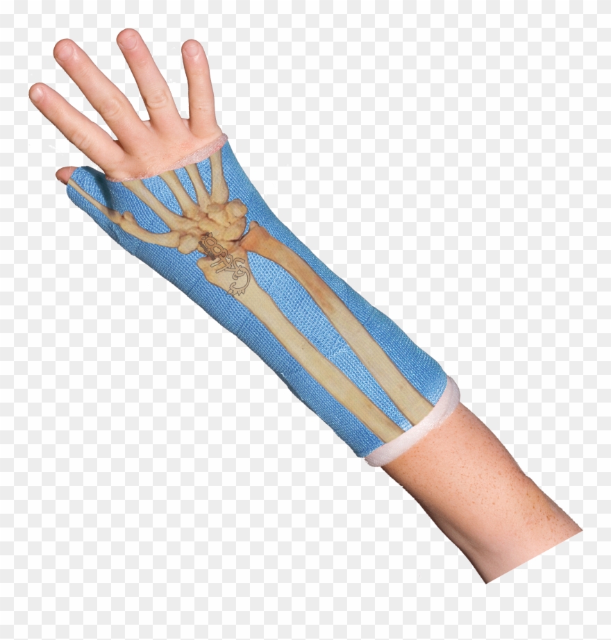 Bones Wrist Bones Casttoo Orthopedic Cast Tattoos Gif Clipart