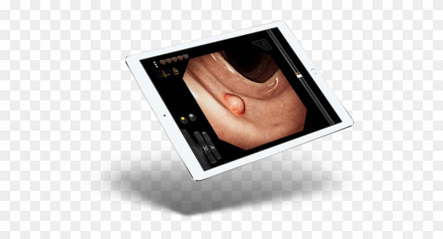 Experience Gastro Ex, The First Virtual Surgery Mobile Clipart