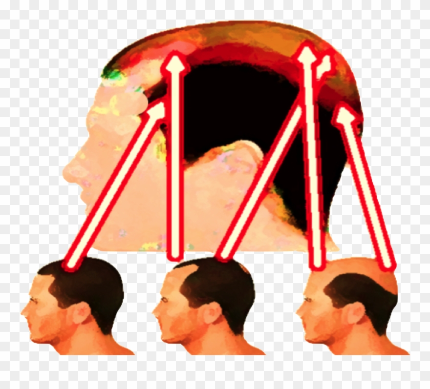 Http - //www - Endhairloss - Eu The Best All Natural Clipart