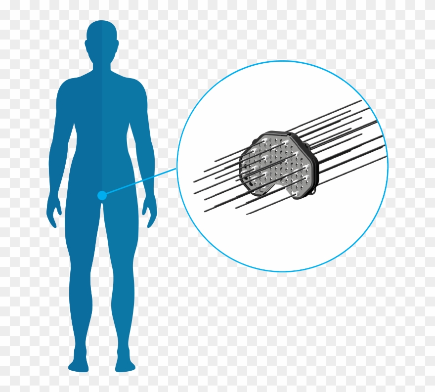 Prostate Applicators<br>and Templates Clipart