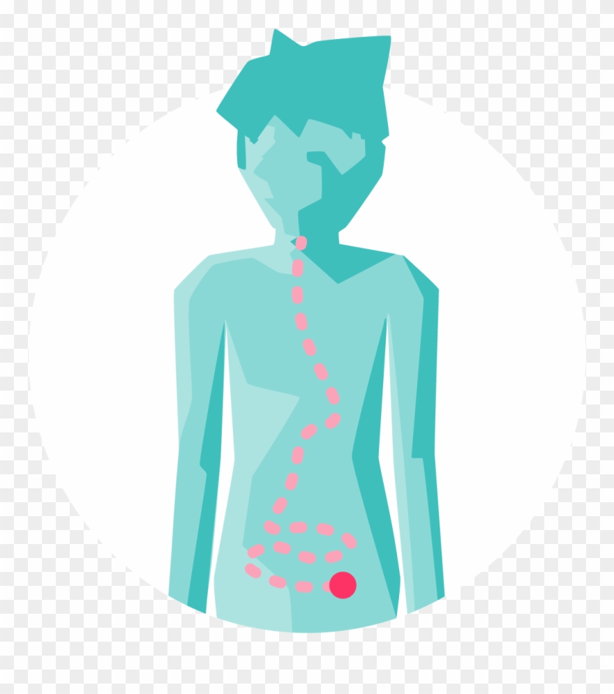 Inflammatory Bowel Disease Clipart