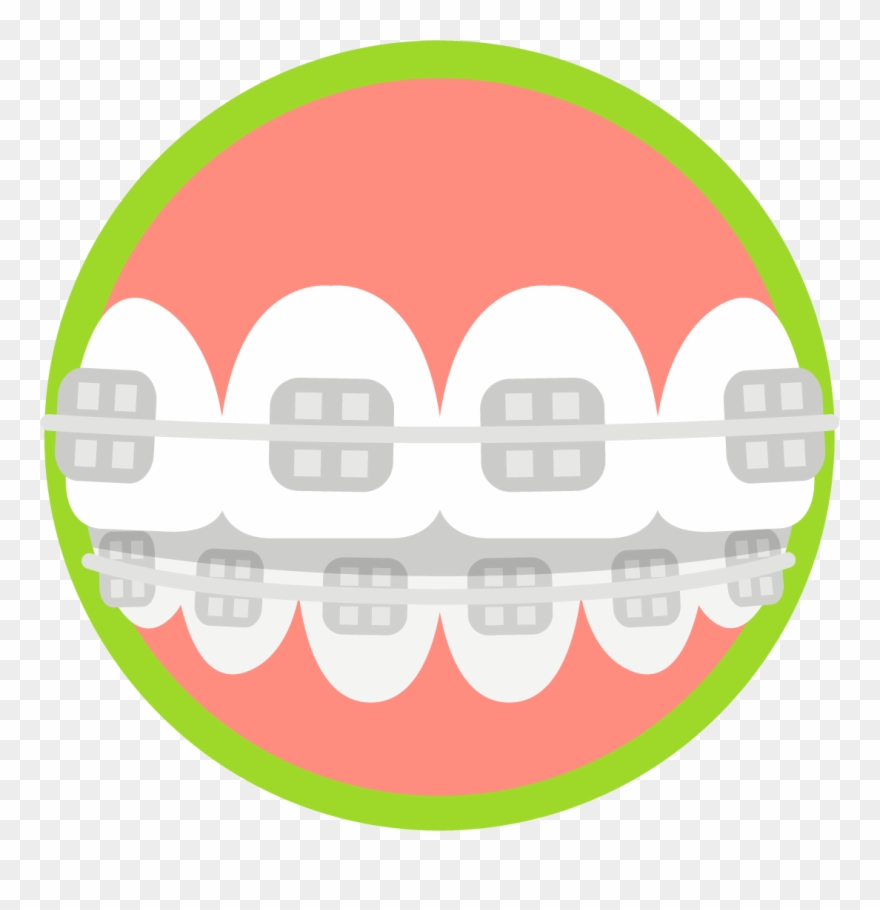 Blue Wave Orthodontics Invisalign And Braces Tampa - Dental Braces Clipart