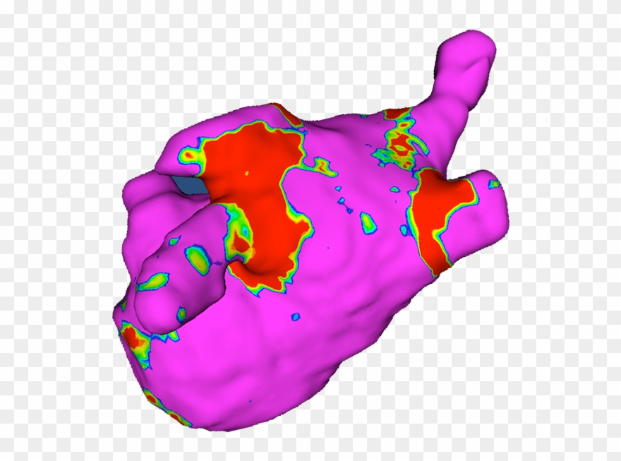 Adas-af Product Characterize The Tissue Of The Left Clipart