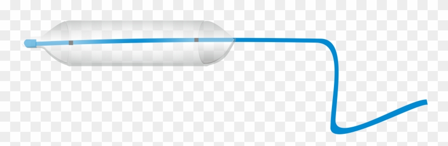 Achalasia Balloon Dilator Clipart