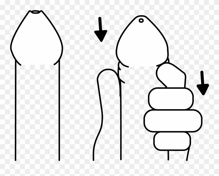 How Do I Use A Condom Clipart