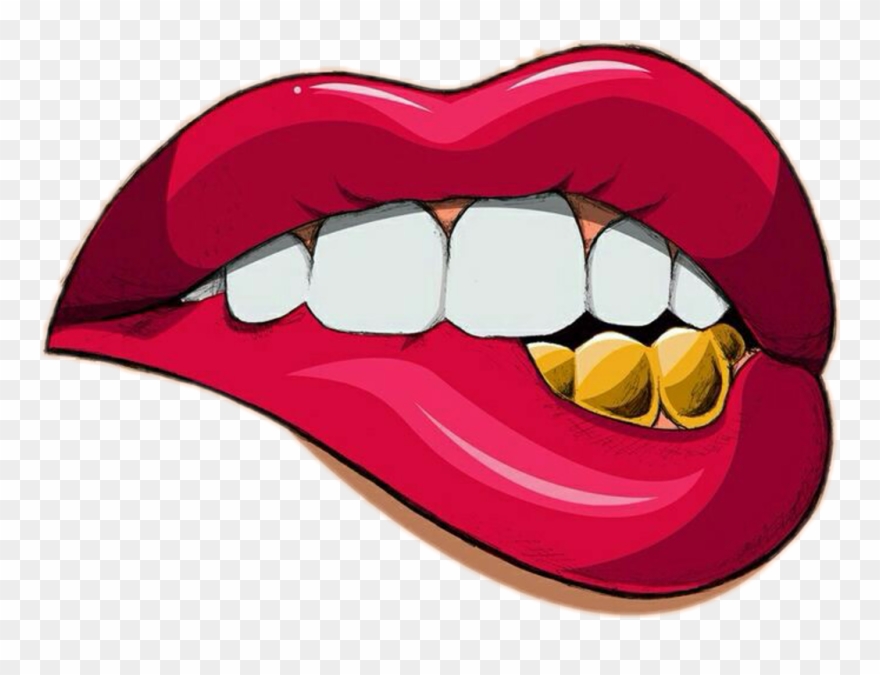 Tooth With Braces Clipart - Png Download