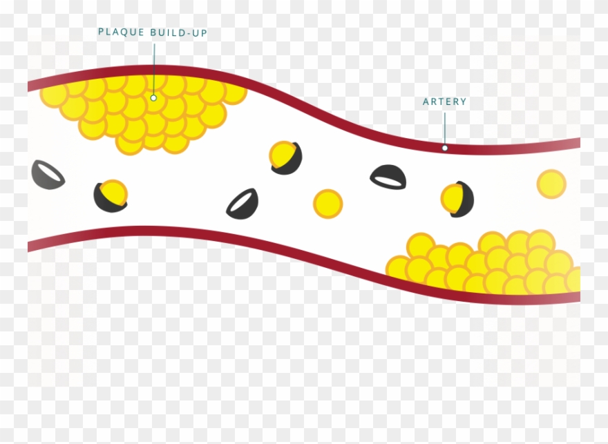 Bad Cholesterol Clipart