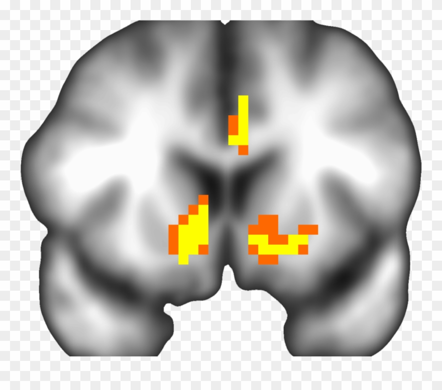 Mcab Lab Journal Club Clipart