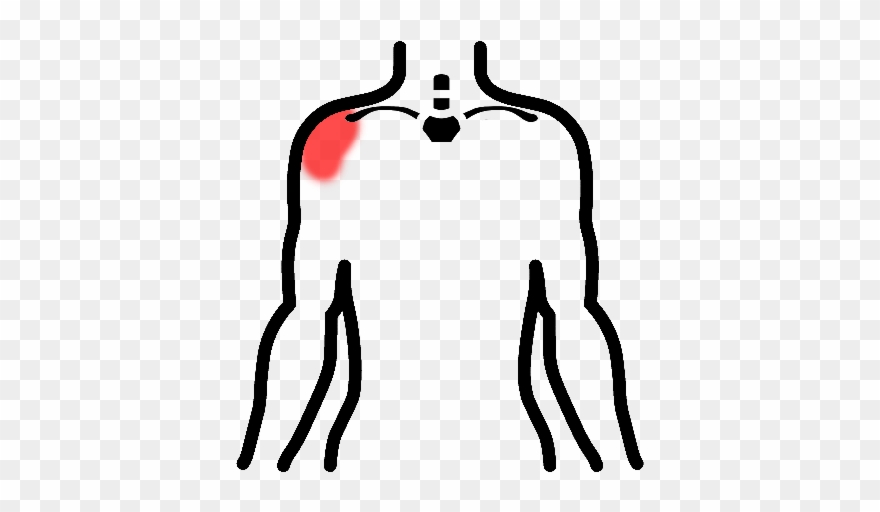 Biceps Tendinosis Clipart