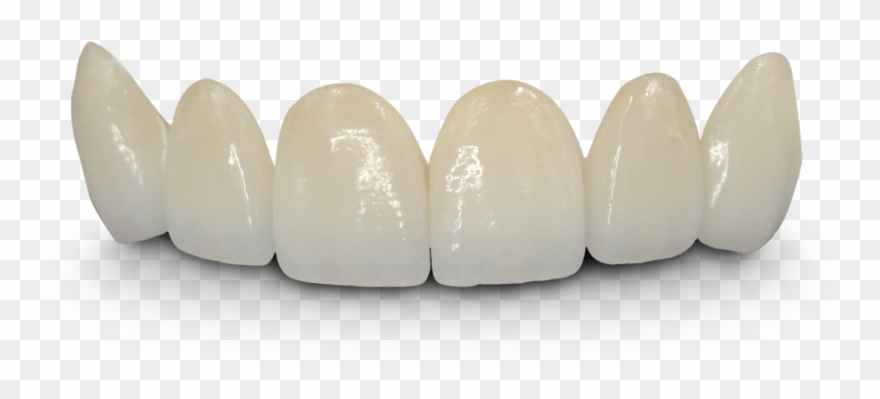 Teeth Png Hd - Crown And Bridge Hd Clipart