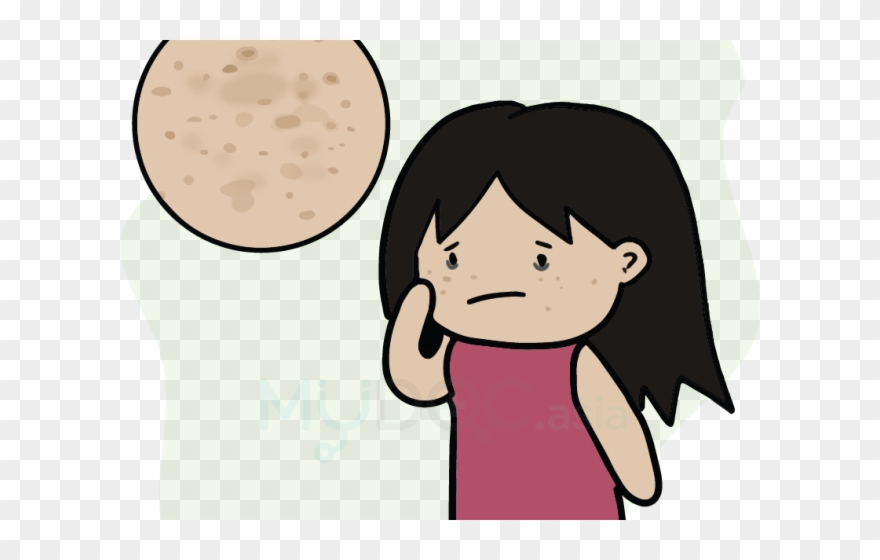 Eye Patch Clipart Translucent - Cartoon - Png Download