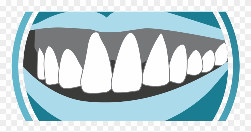 Gum Problems, Gum Problems Newcastle, Healthy Gums, Clipart
