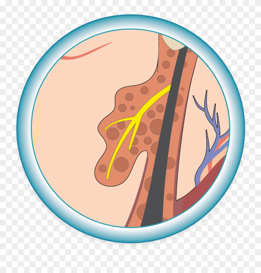 Reduktion Der - Talgproduktion - Simbolo Da Engenharia Civil Clipart