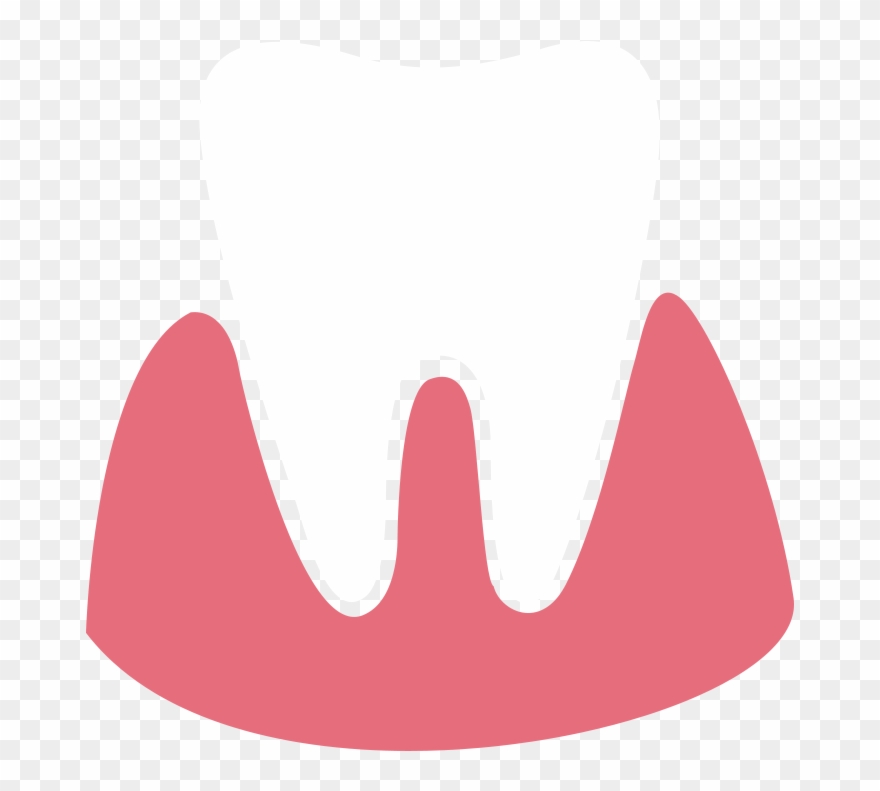 5 Things You Should Know About Gum Problems Clipart