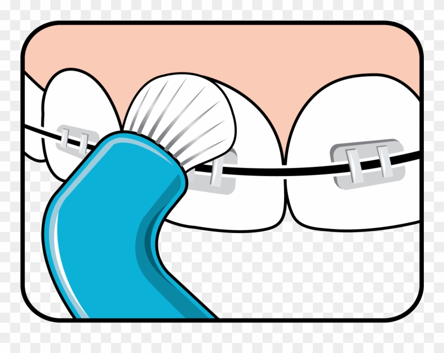 Effective Cleaning Along The Gum Line Clipart