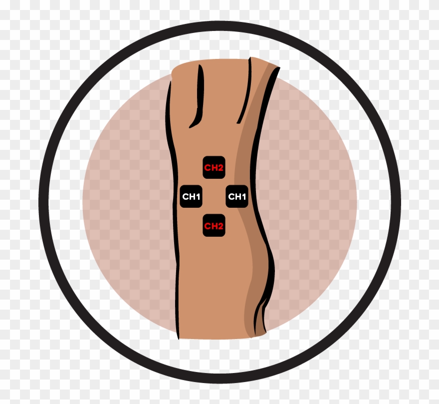 Electrode Pad Placement By Body Part Part - Electrical Muscle Stimulation Clipart