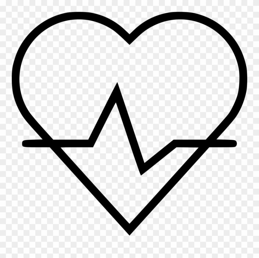 Png File - Bending Moment In Continuous Beam Clipart