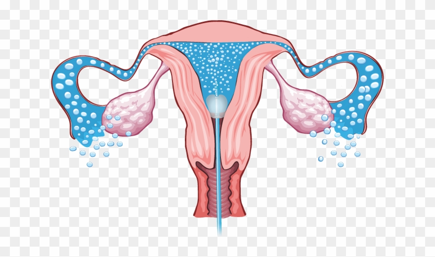 Cost-effective, Convenient, And Proven - Female Reproductive System Without Names Clipart