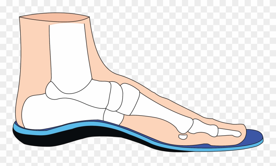 Resonance Dynamic Foot Orthotics Clipart