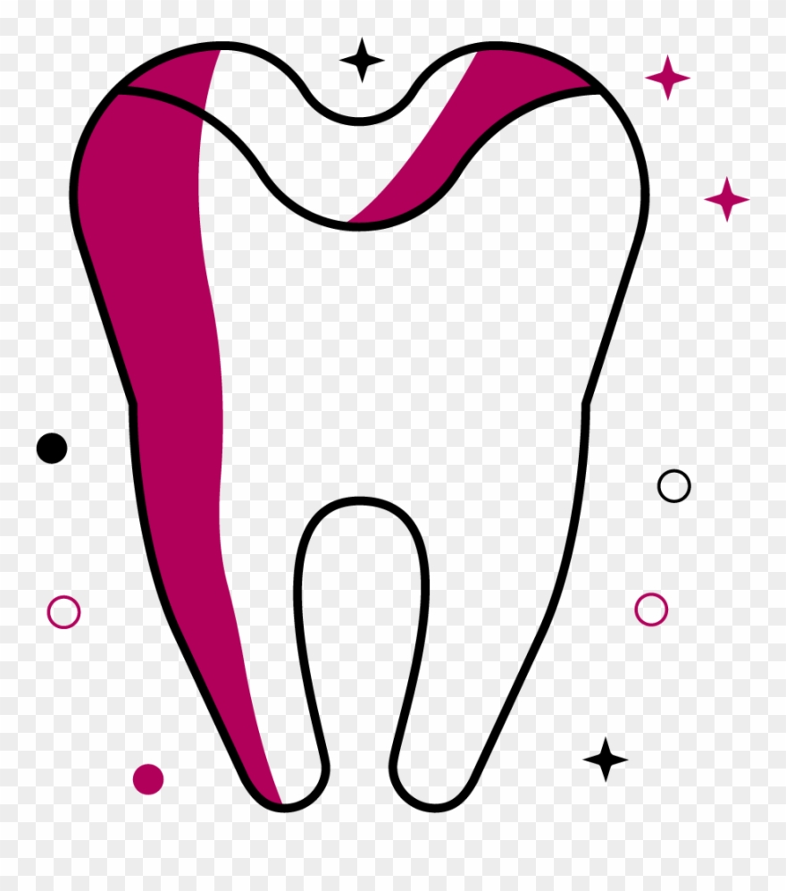 Tooth-coloured Dental Filling Clipart