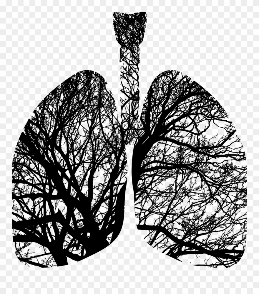 Pochp - Air Pollution In Macedonia Clipart