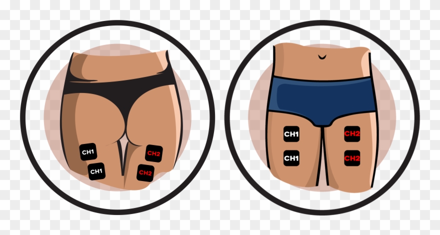 Thigh Electrode Pad Placement Clipart