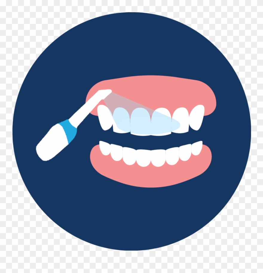 Intraoral Scanning Clipart