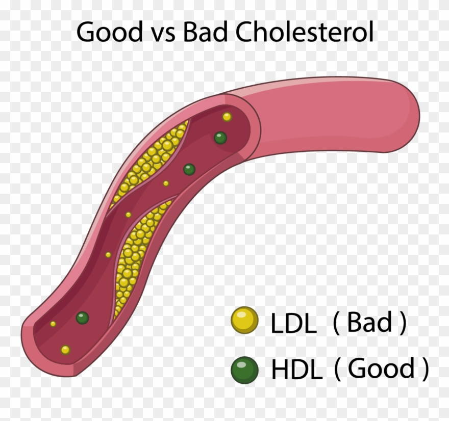 Goodvsbad Cholesterol - Good Bad Cholesterol Clipart