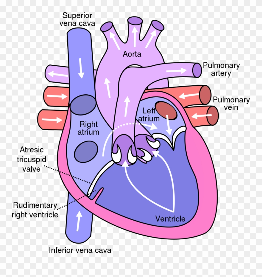 File - Tricuspid Atresia - Svg - Diagram Of The Heart Clipart