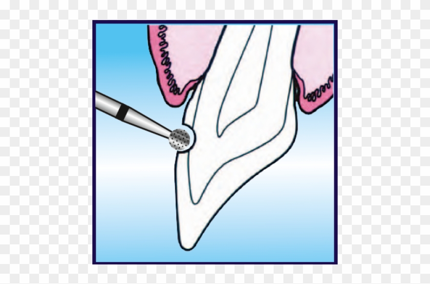 Description - Sketch Clipart