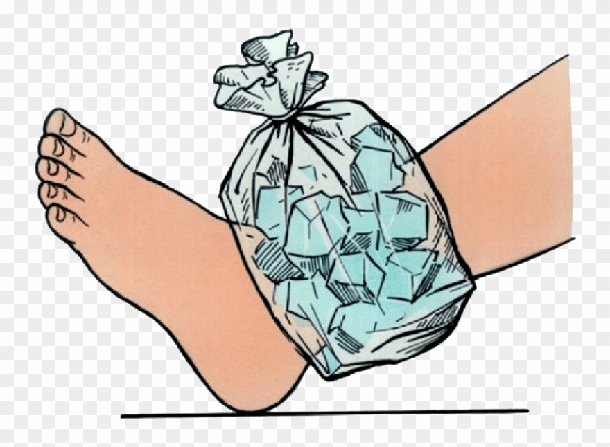 Icing Helps - Ice On Ankle Clipart - Png Download