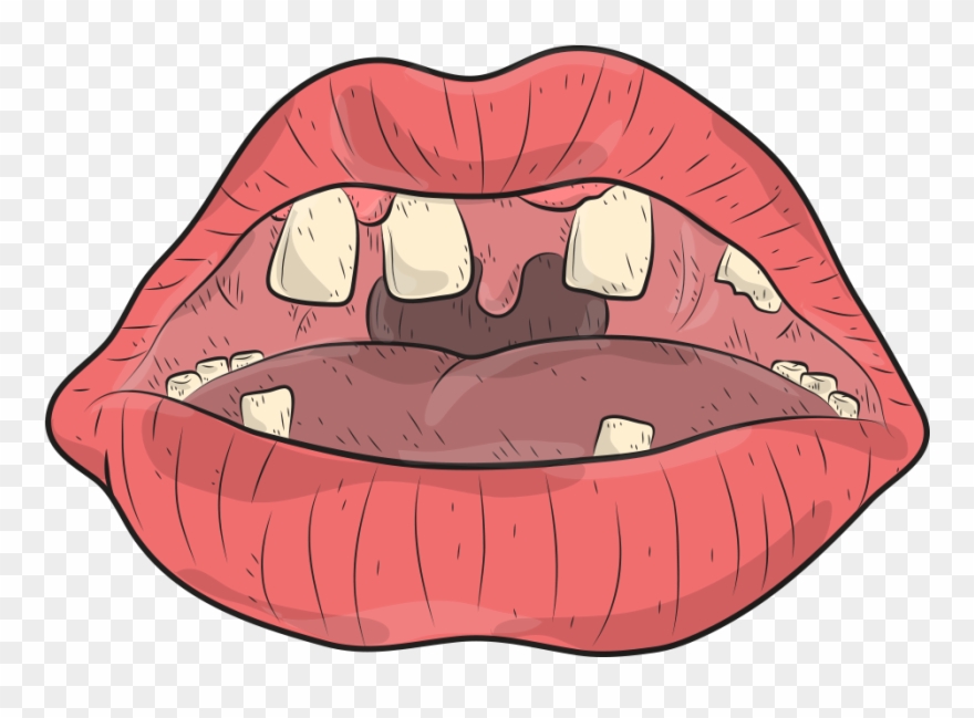 Tieri Wince , Ugo Zamponi ( Motion ) - Nrh2o Clipart