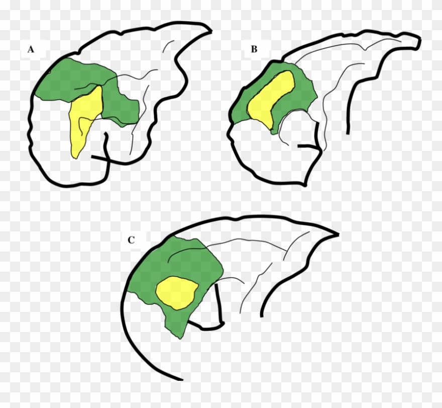 Comparison Of Approximate Locations Of Areas 9 And Clipart