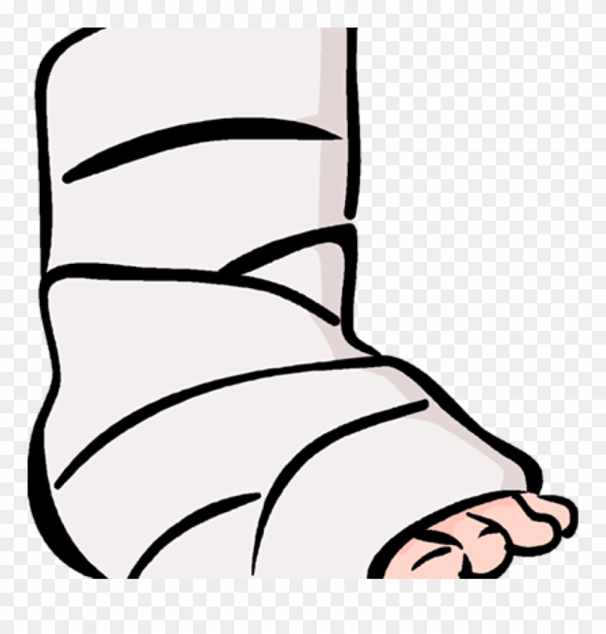 Broken Clip Art 15 Broken Clipart Broken Ankle For - Broken Ankle Clipart Transparent - Png Download