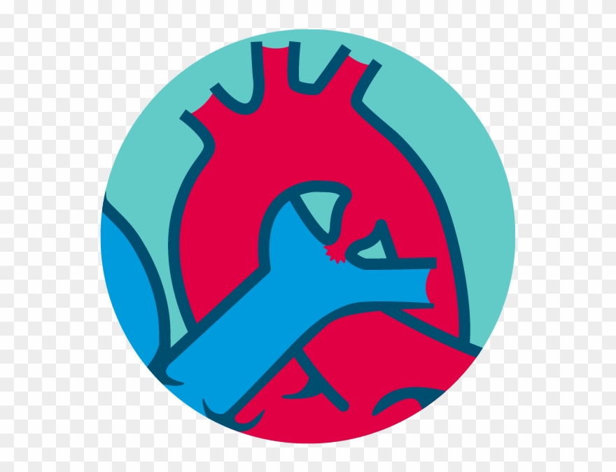 Type A - Conical - Circle Clipart