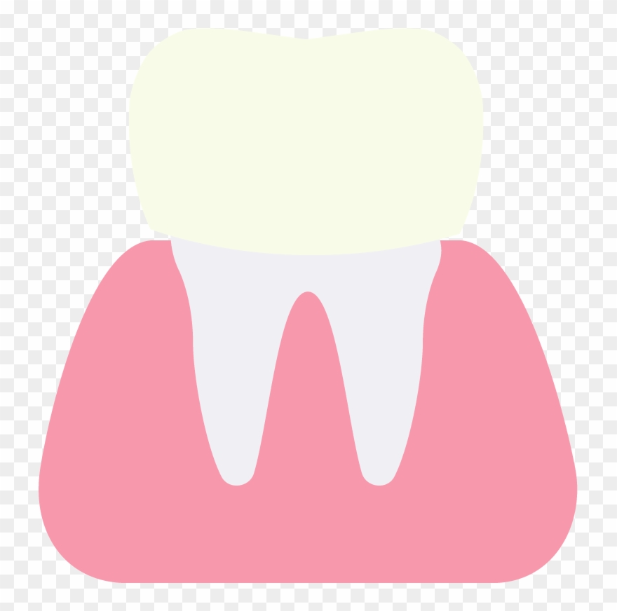 Dental Crowns Clipart
