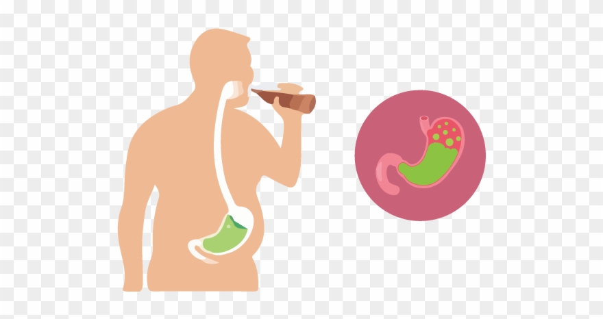 10 Natural Remedies For Acid Reflux - Illustration Clipart