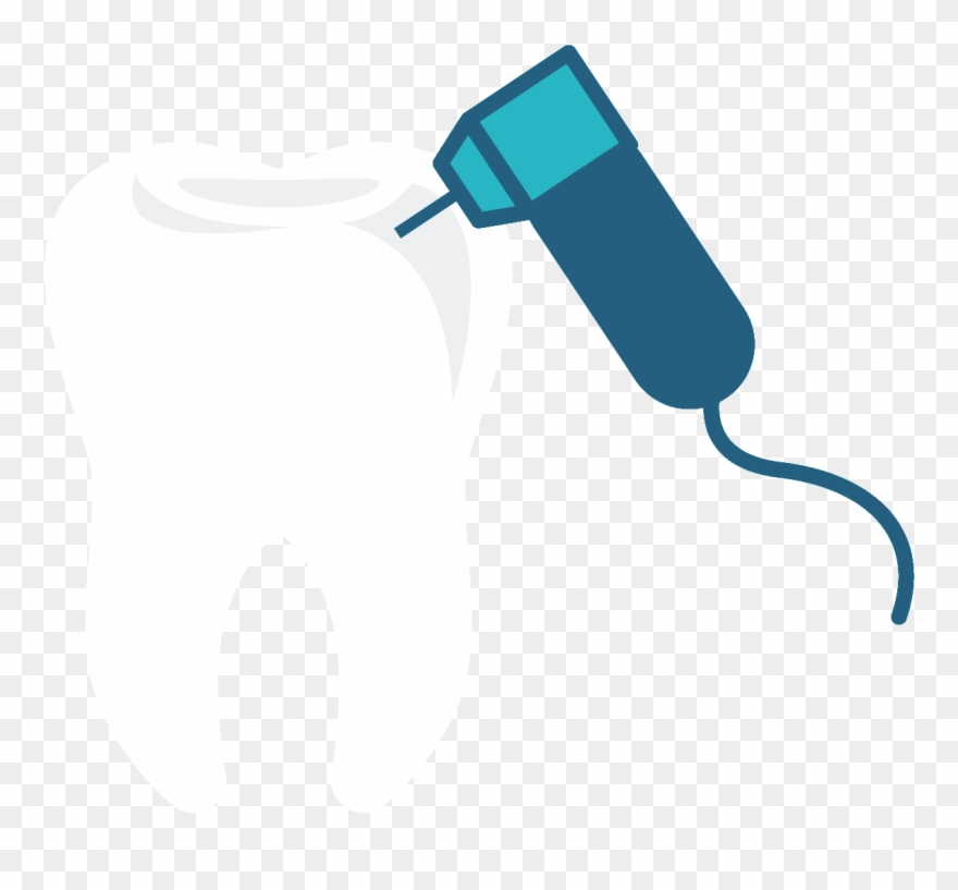 Implant Dentistry - Gif De Cirugia Odontologica Clipart