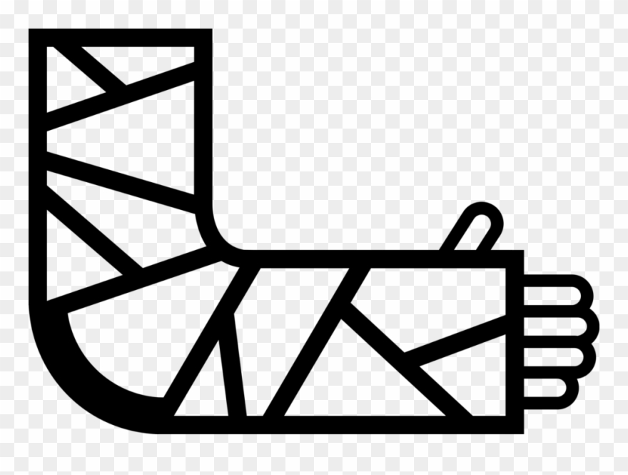 Vector Illustration Of Patient's Broken Arm In Plaster - Broken Arm Clip Art - Png Download