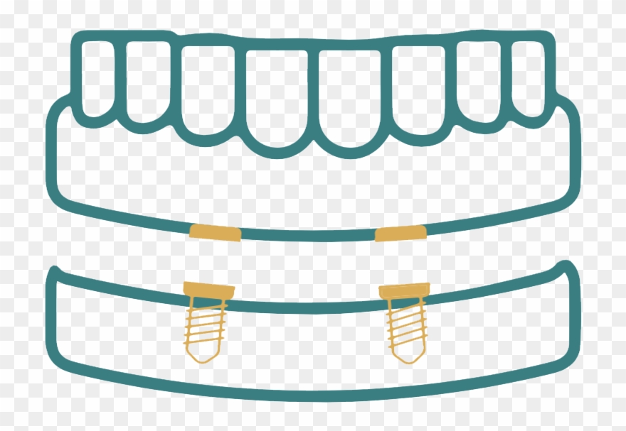 Full Mouth Rehabilitation Png Clipart